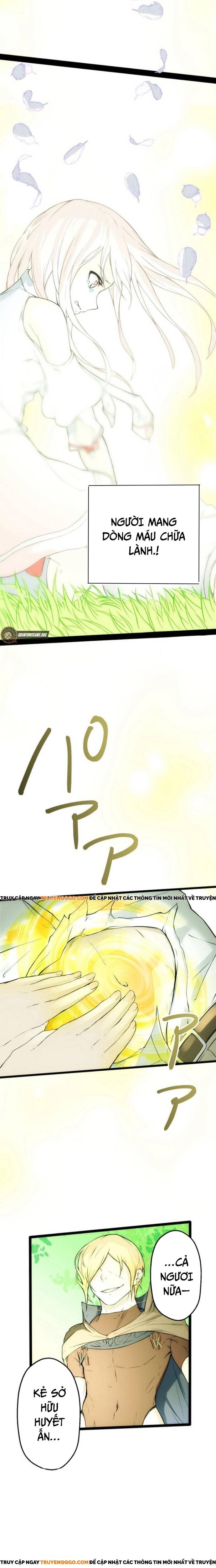 Bc: Dị Biến Trong Huyết Quản Chap 2 - Next Chap 3